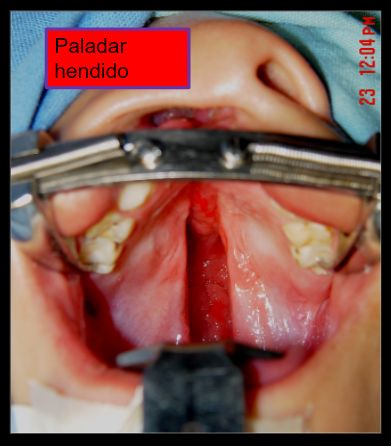 Diana Araceli Dávila Hernández-27