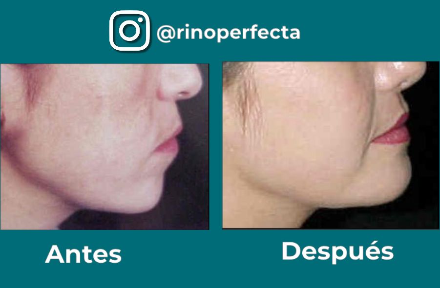 Juan Manuel Esparza Alejandre-13