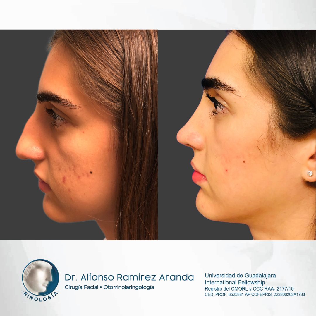 Alfonso Ramírez Aranda-27