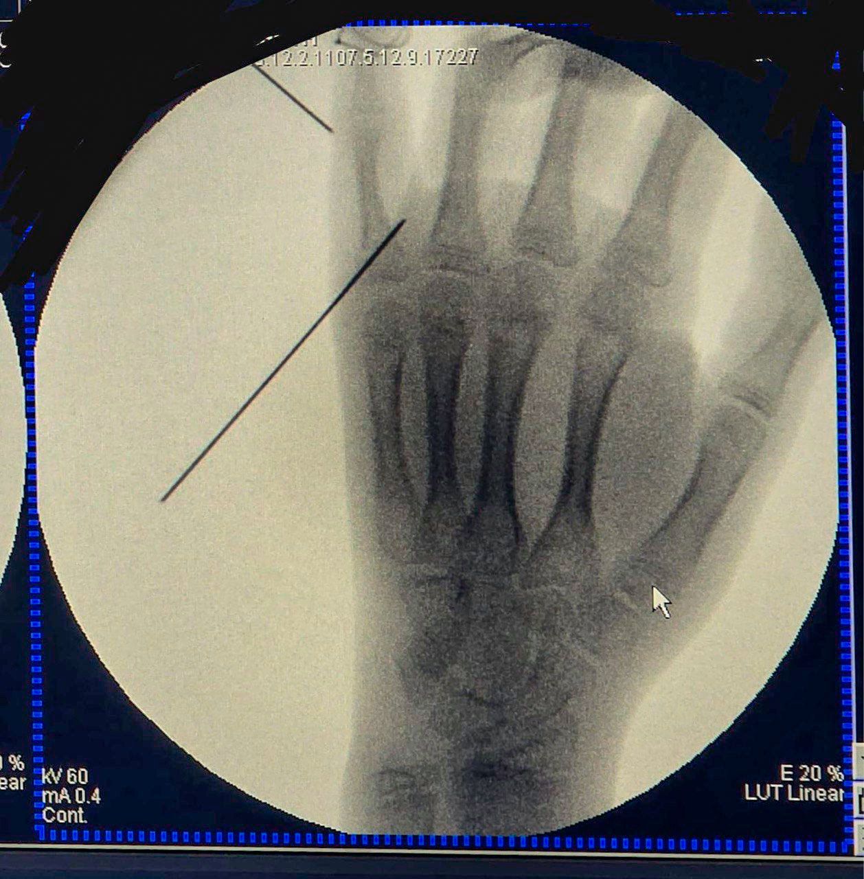 Oscar López Urrutia-18