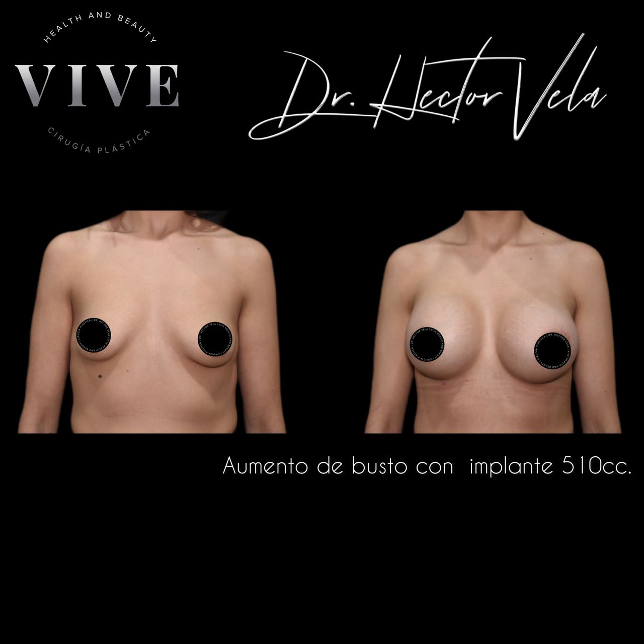 Héctor Eduardo Vela Cardona-56