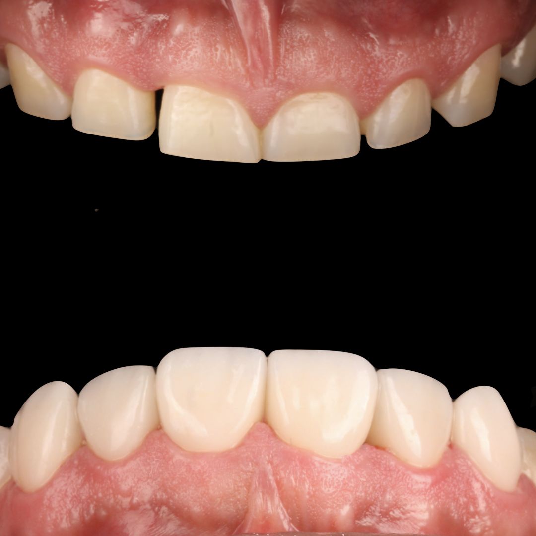 Miguel Alberto Escalona Mora-0