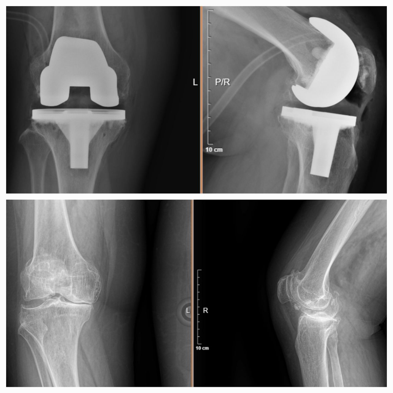 Jesús Eliseo Córdova Franco-55