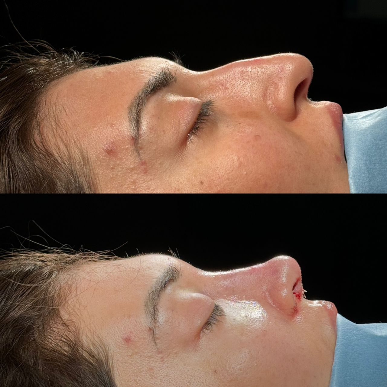 Angel Castro Urquizo-97