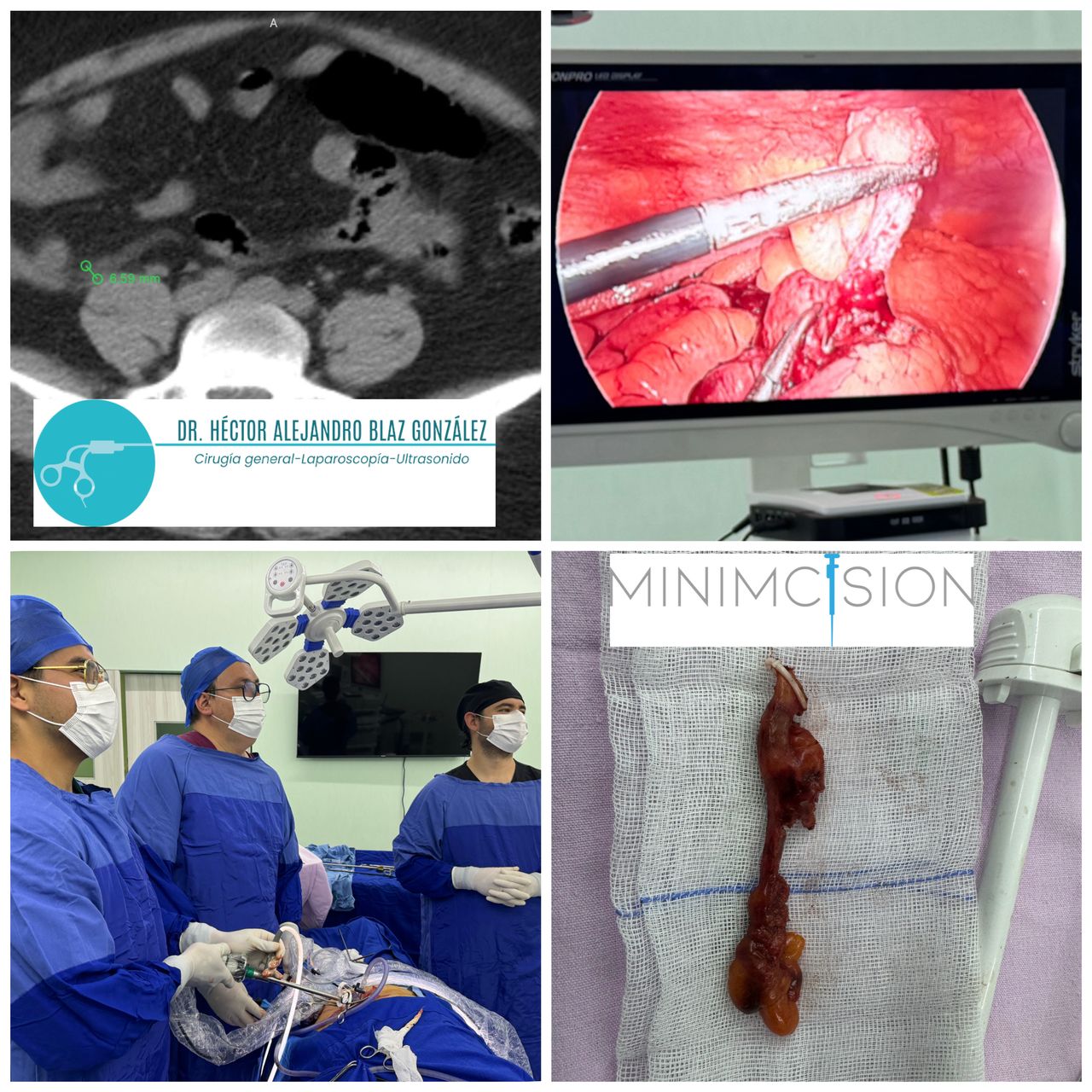 Hector Alejandro Blaz Gonzalez-3