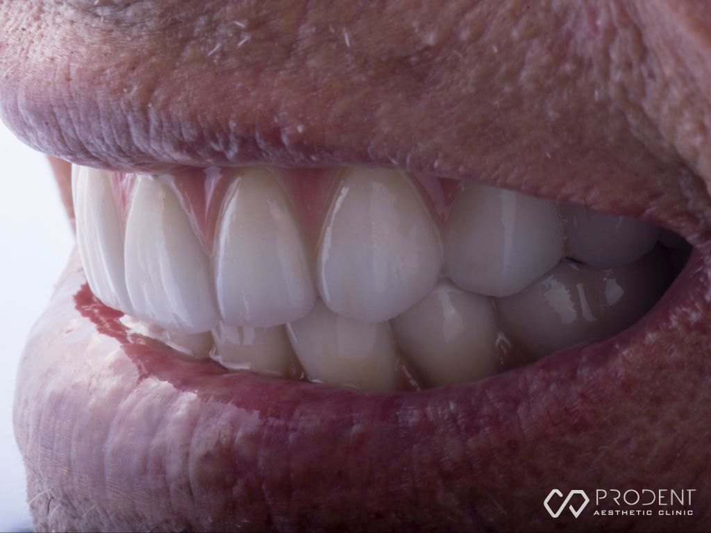 Ulises Pérez Murillo-44