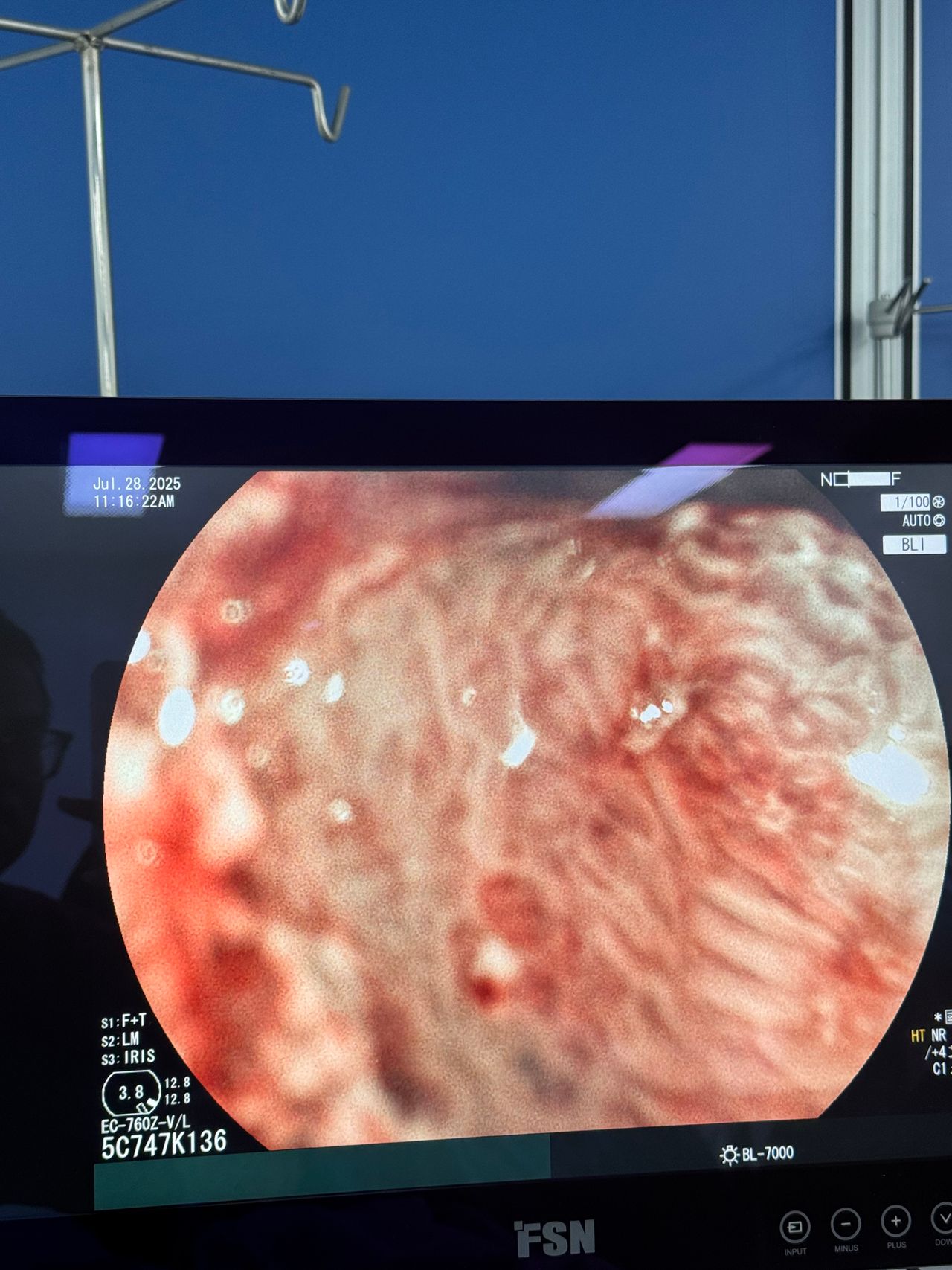 Jorge Alberto Ortega Tecuatl-6