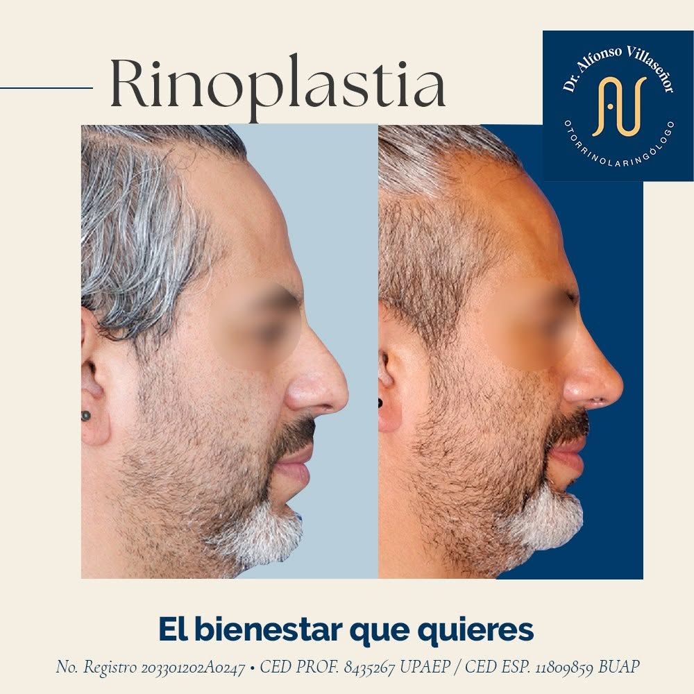 Alfonso Villaseñor Herrero-46