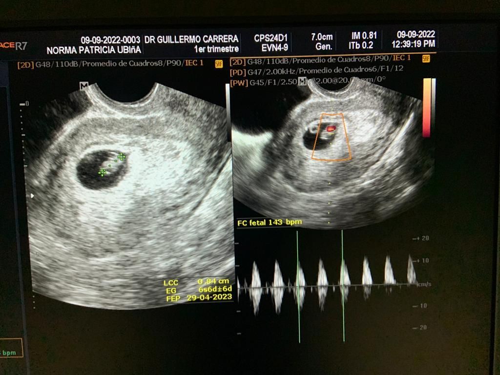 Guillermo Carrera Franco-2