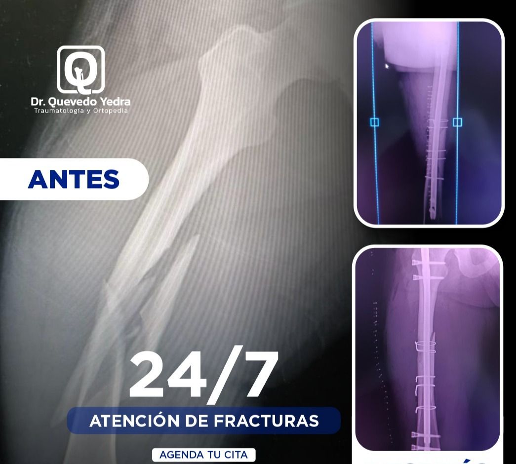 Eddy Quevedo Yedra-0