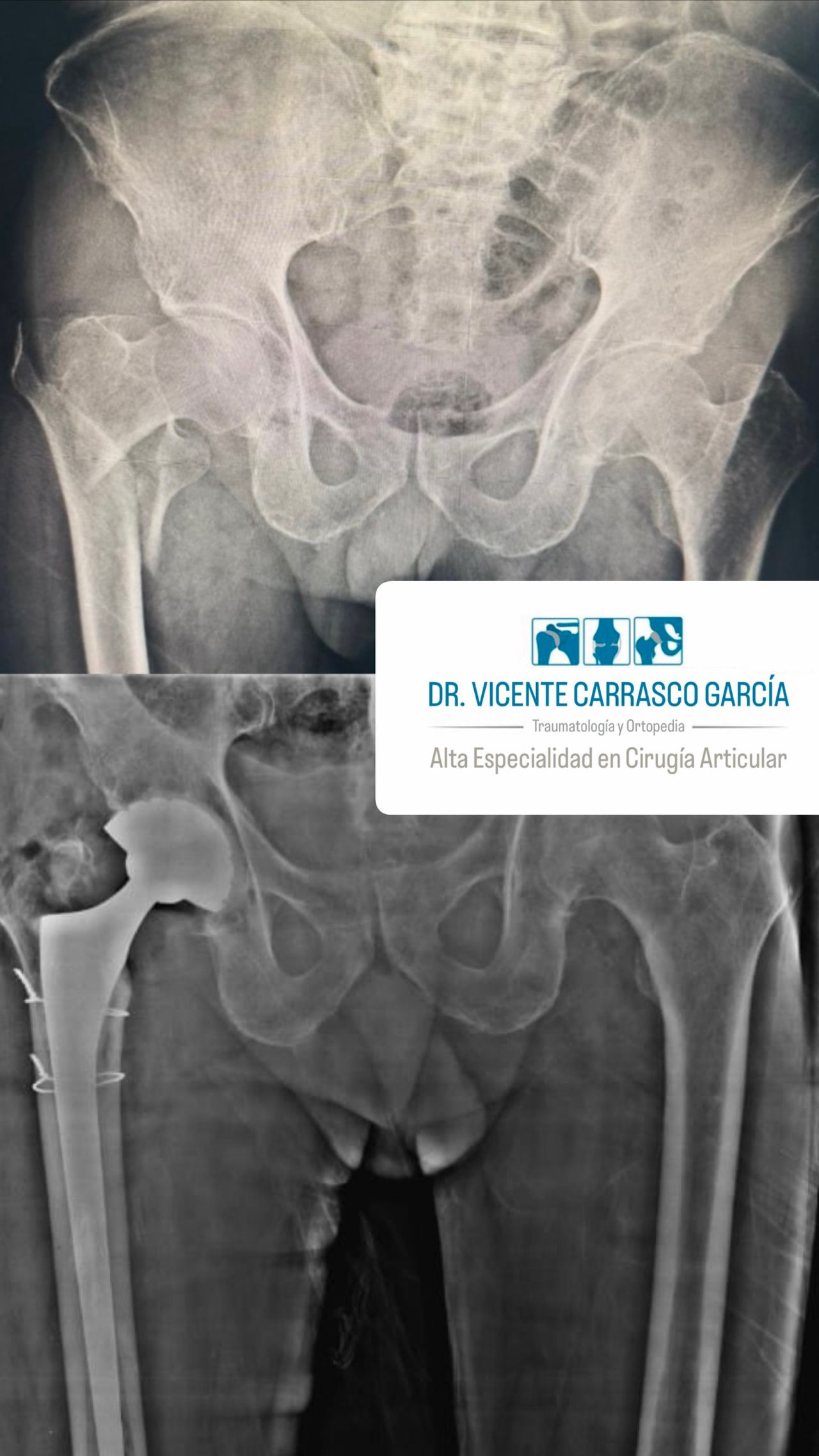Vicente Carrasco García-23