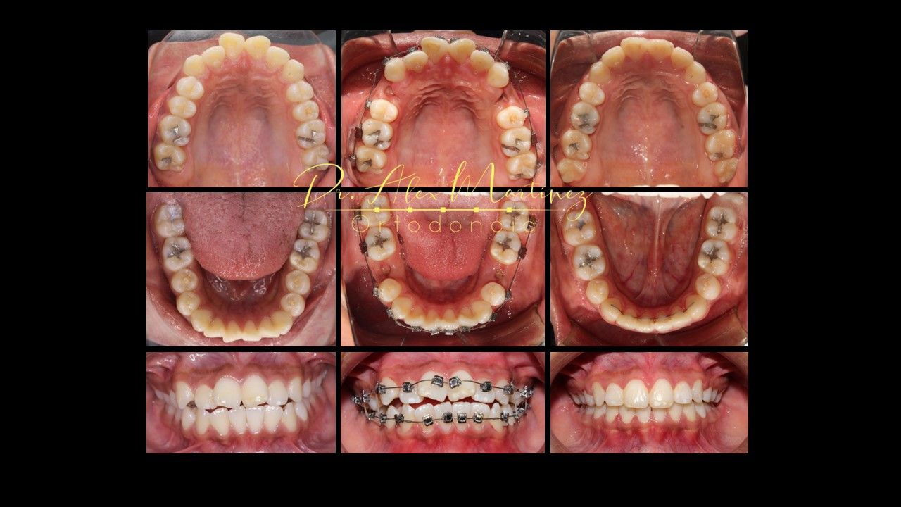 Alejandro Martínez Hernández-2