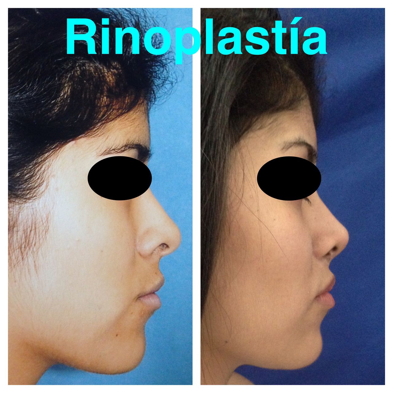 Ubaldo Carpinteyro Espín-3