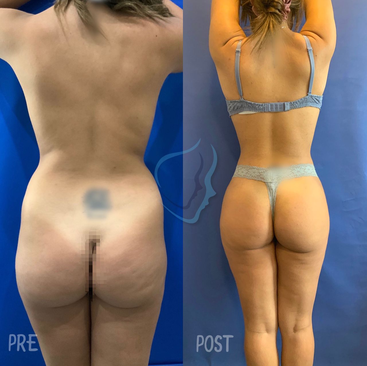 Giuseppe Tanzillo-34