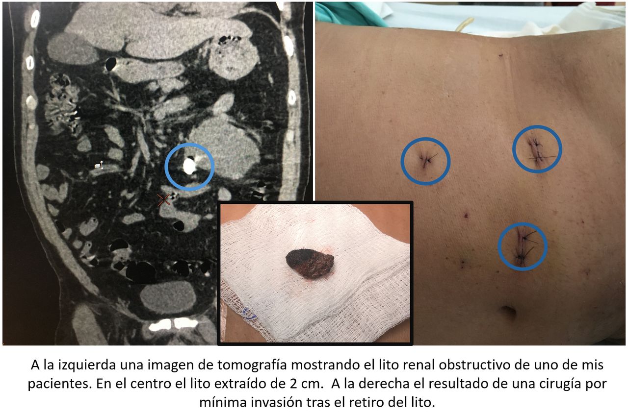 Roberto Pacheco López-1