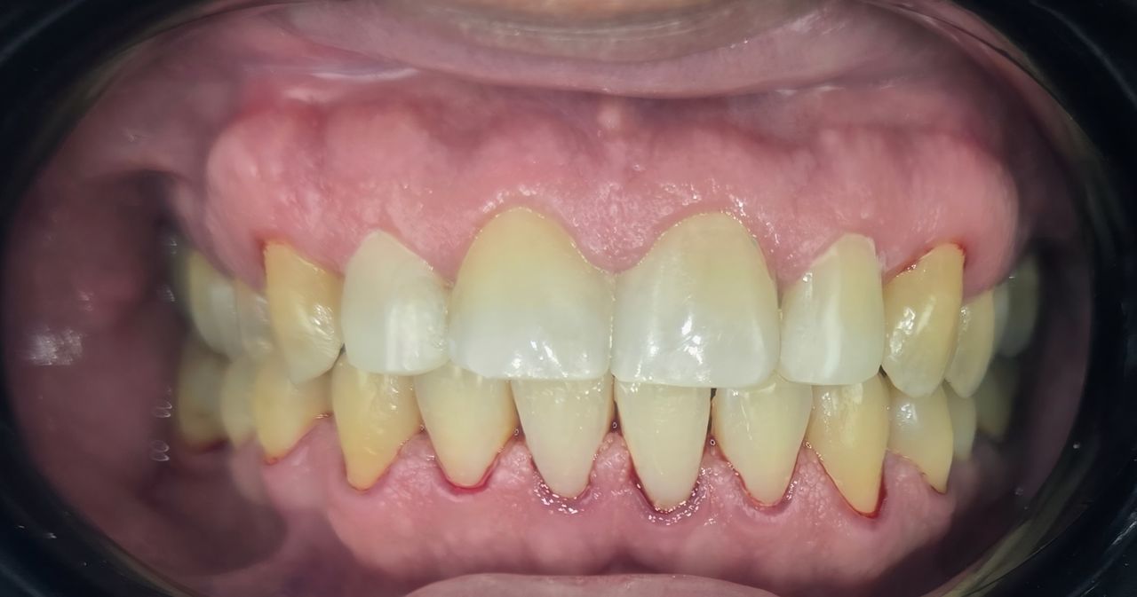 Edgardo Caballero Dávila-18