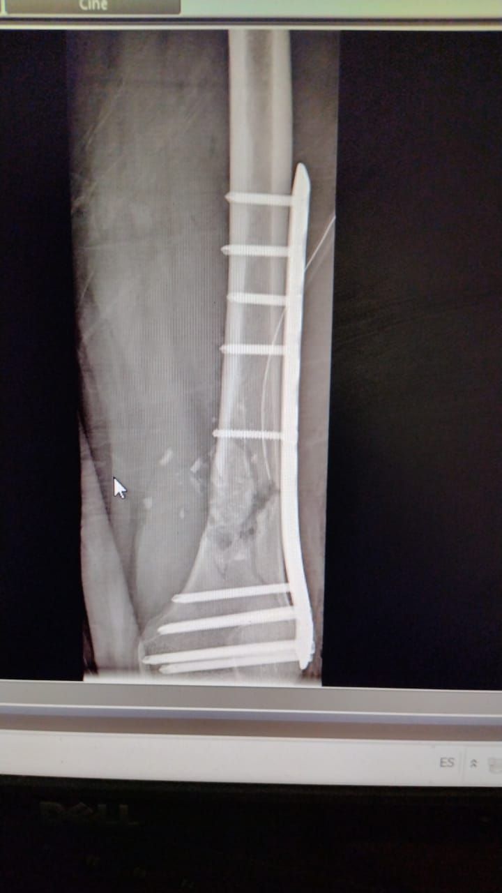 Rodrigo F. Durán Martínez-14