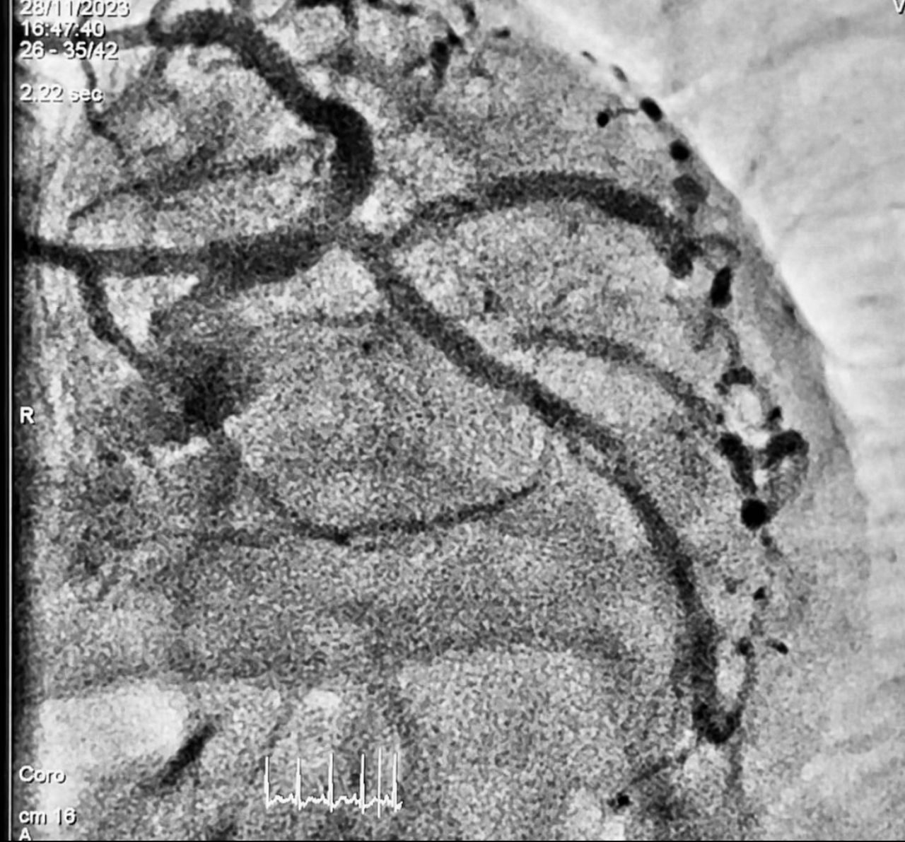 Abdón Ávila Chávez-2