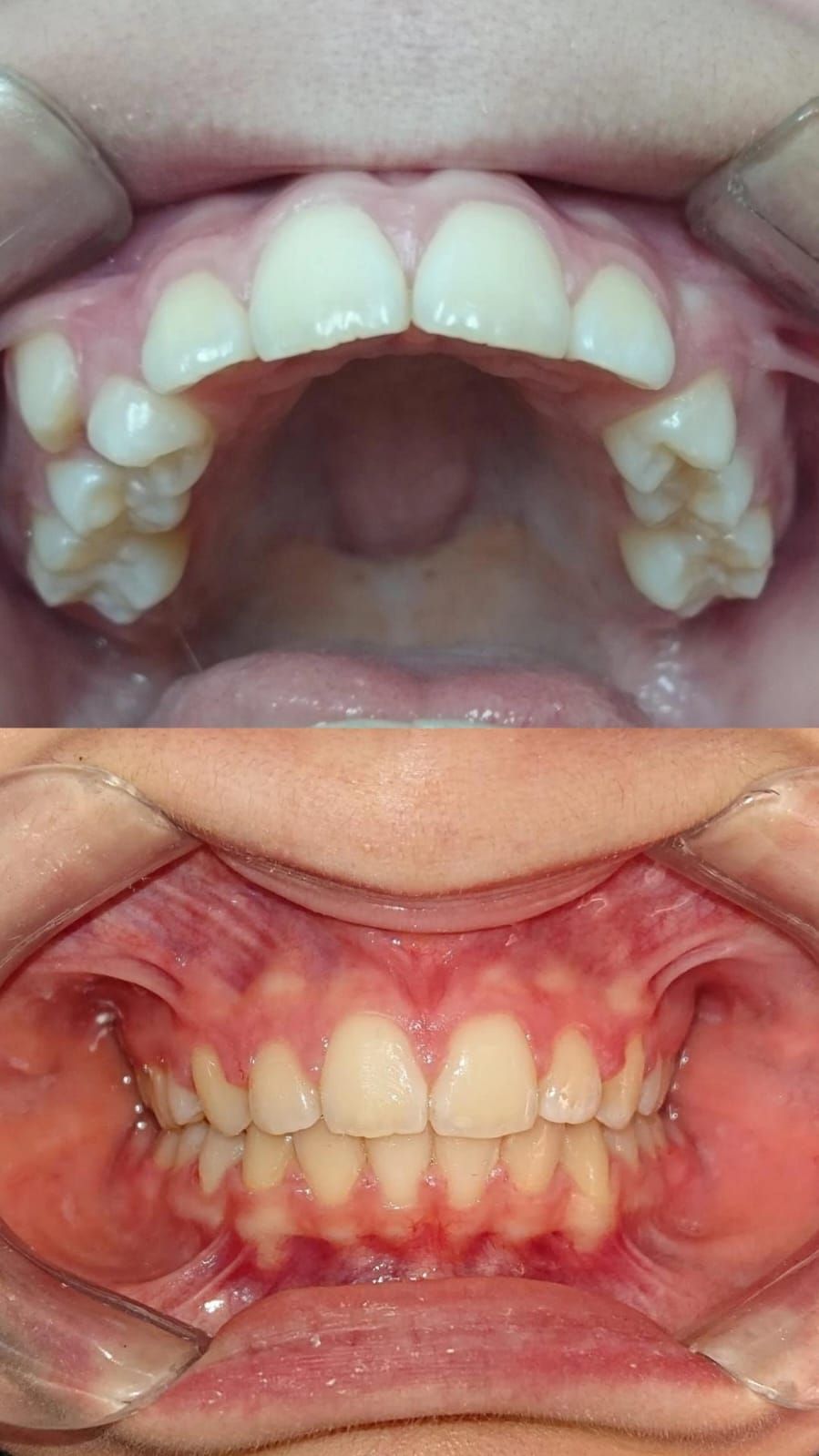 Reyes Silverio Lozano Reza-2