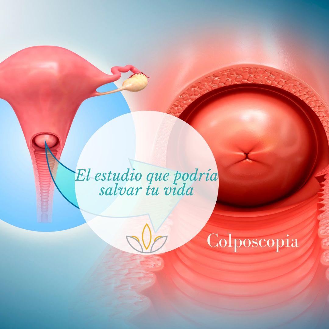 Idalid Torres Sánchez-1