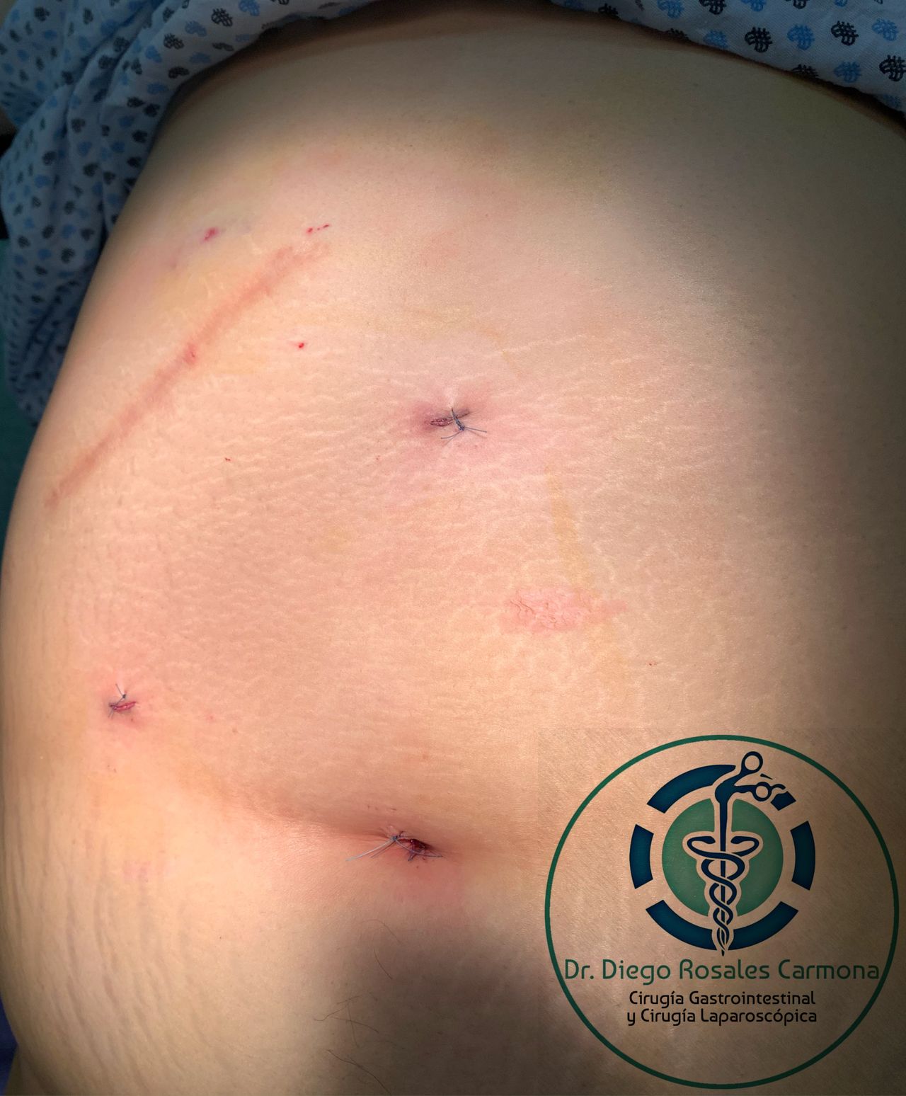 Diego Edwuin Rosales Carmona-13