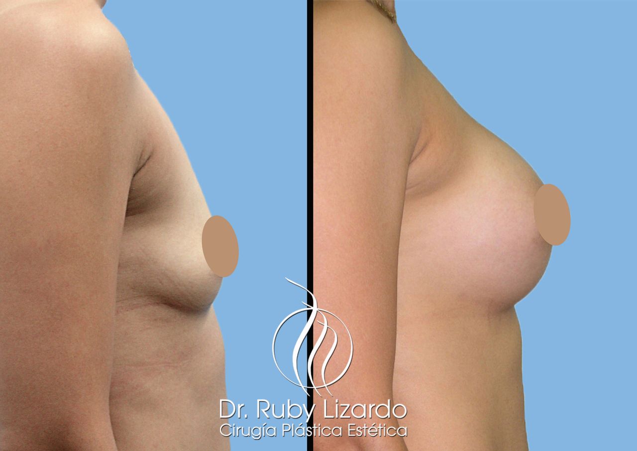 Ruby Lizardo Ramírez Robles-21