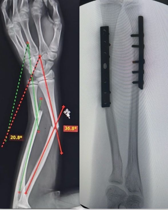 Jorge Antonio Acevedo Valdes-5