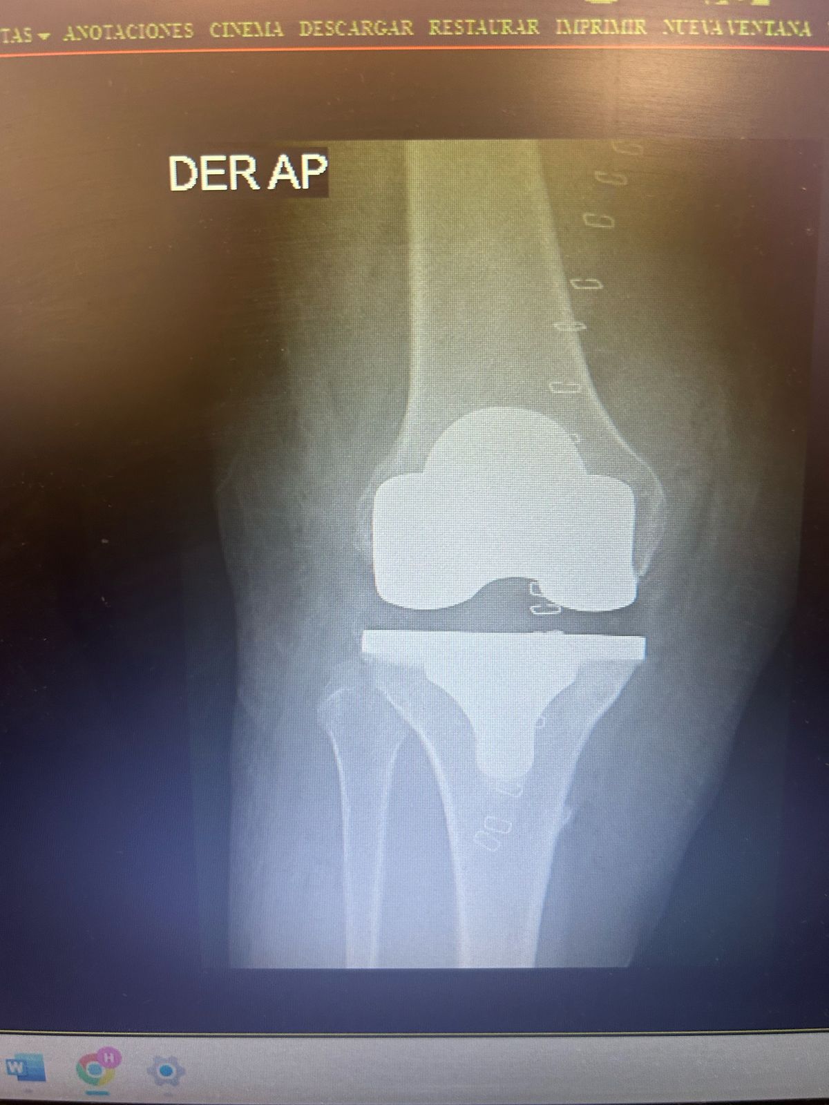 Evaristo De Jesús Castillo García-1