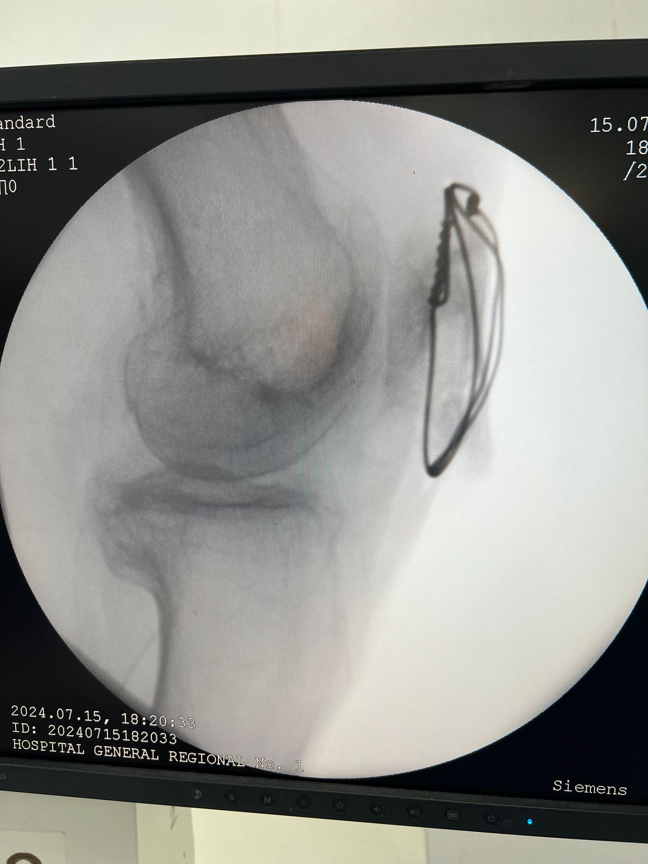 Juan Lopez Valencia-2