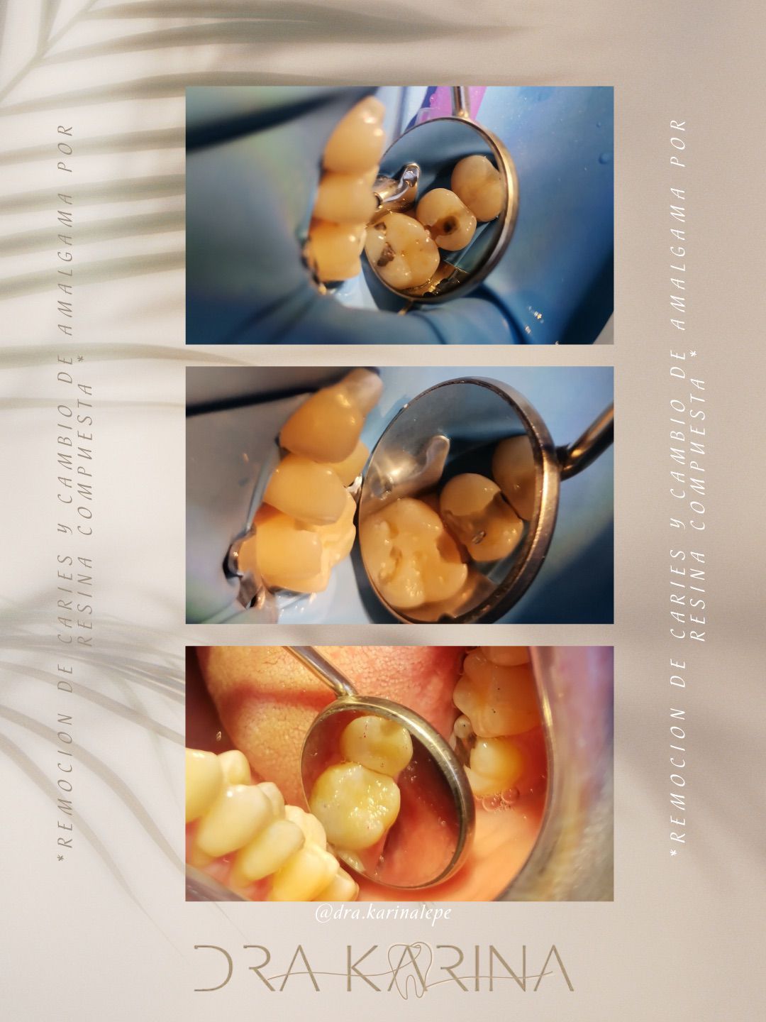 Karina Lepe Pedrajo-4