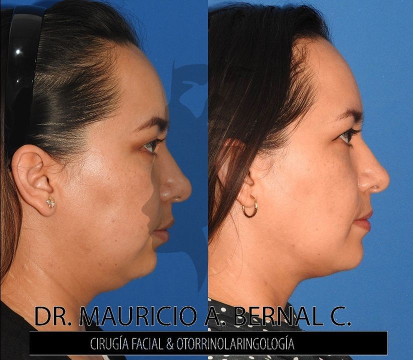 Mauricio Alejandro Bernal Carreon-14