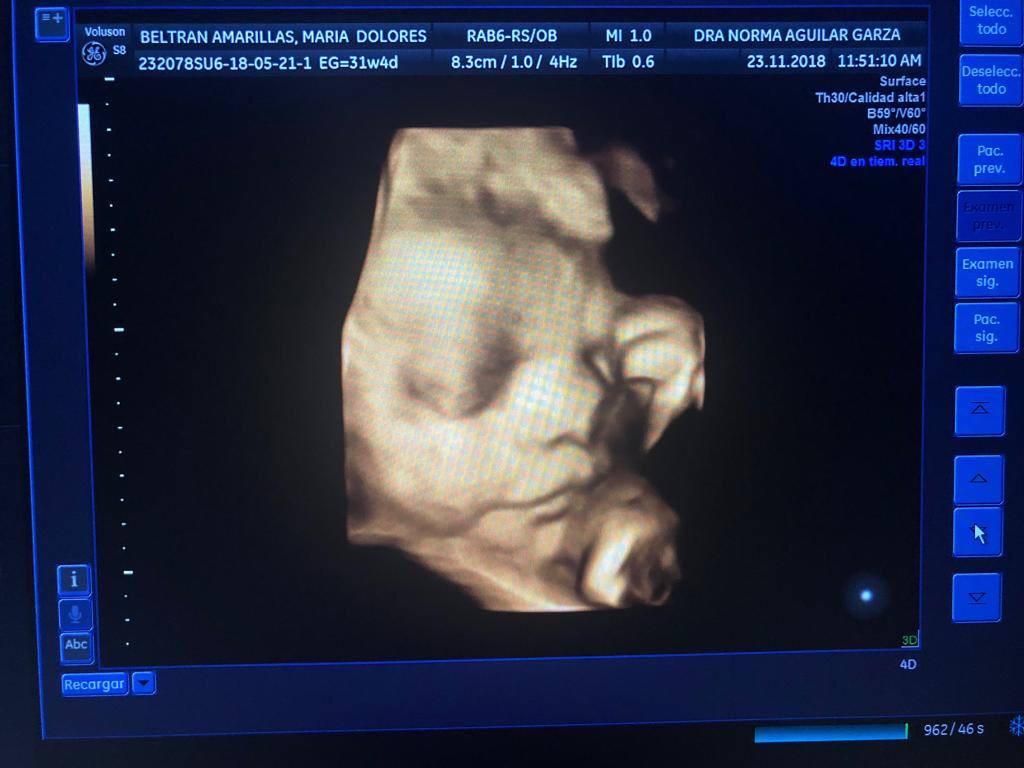 Norma Aguilar Garza-13