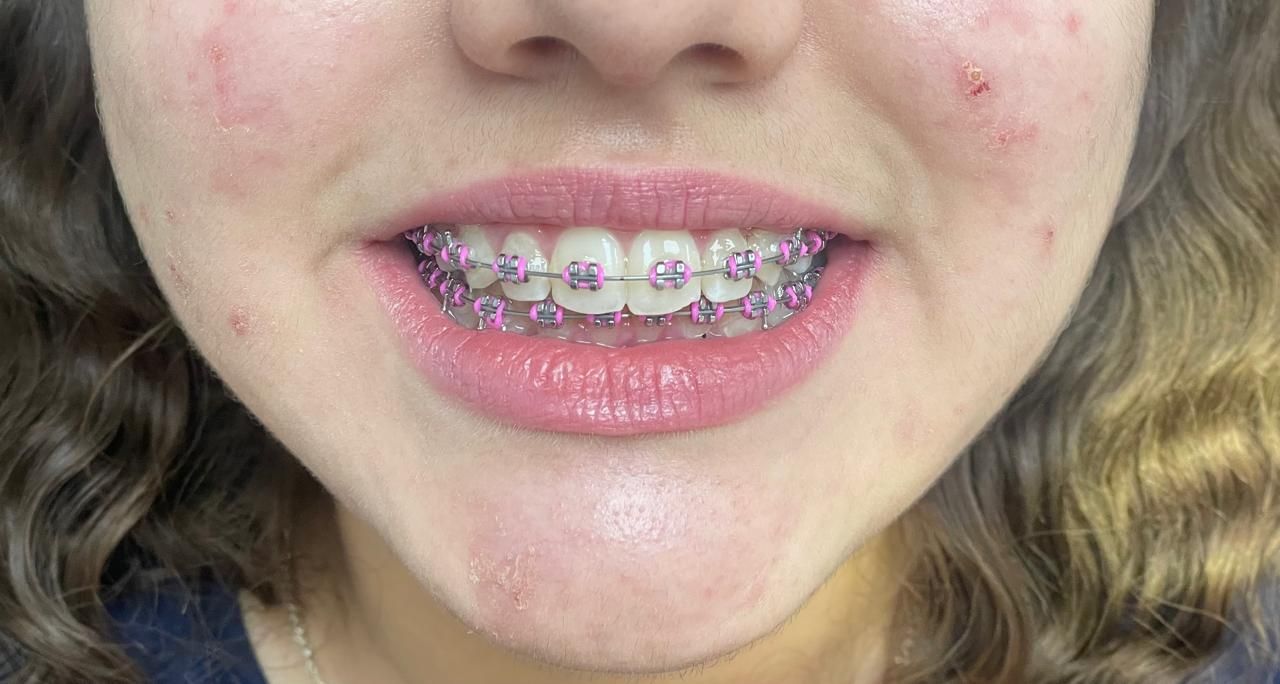 Anuar Becerril Castro-16