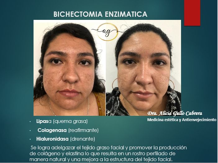 Alicia Gallo Cabrera-20