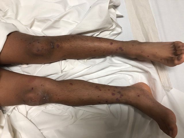 Joel Barroso Santos-53