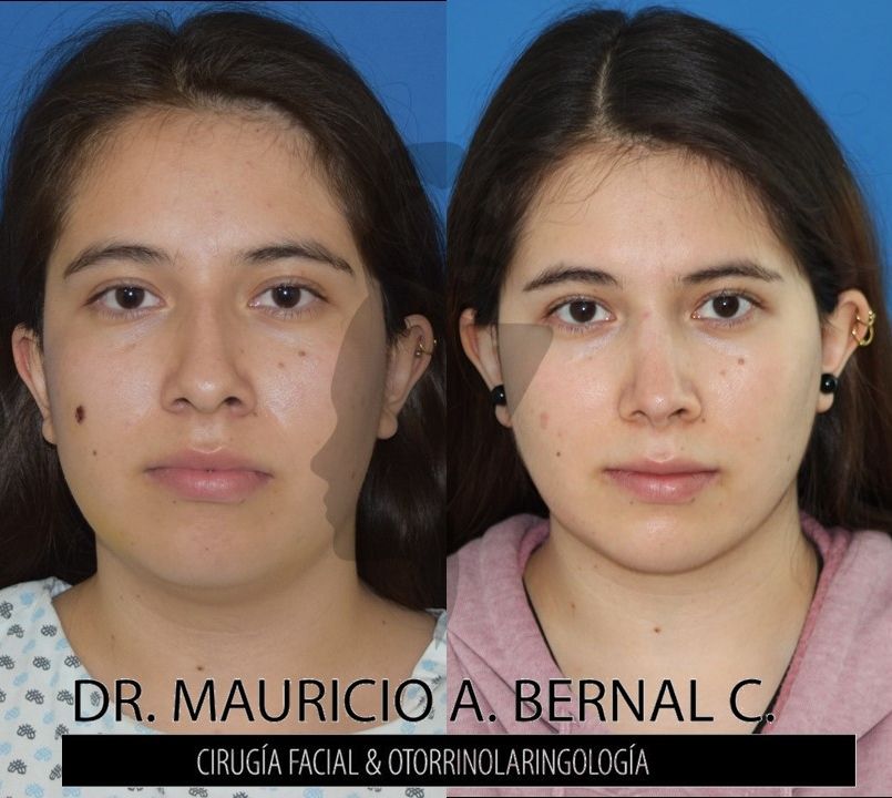 Mauricio Alejandro Bernal Carreon-28