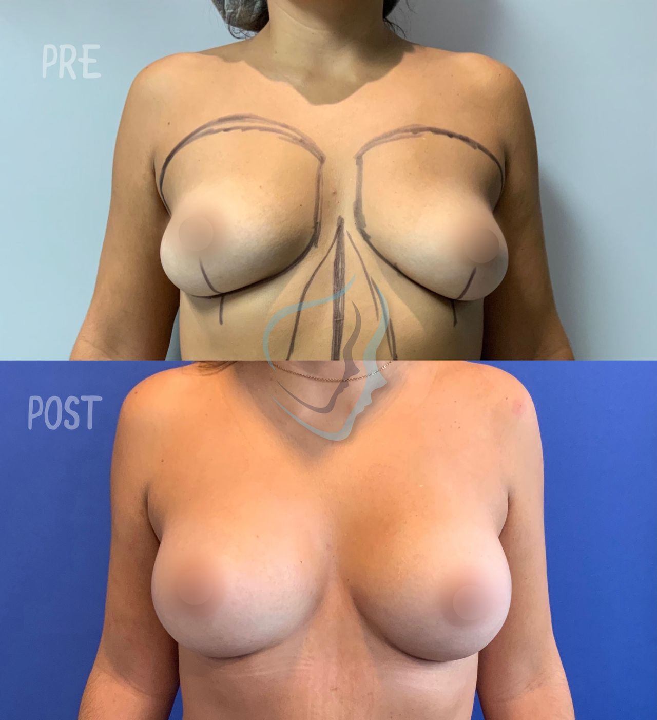 Giuseppe Tanzillo-45