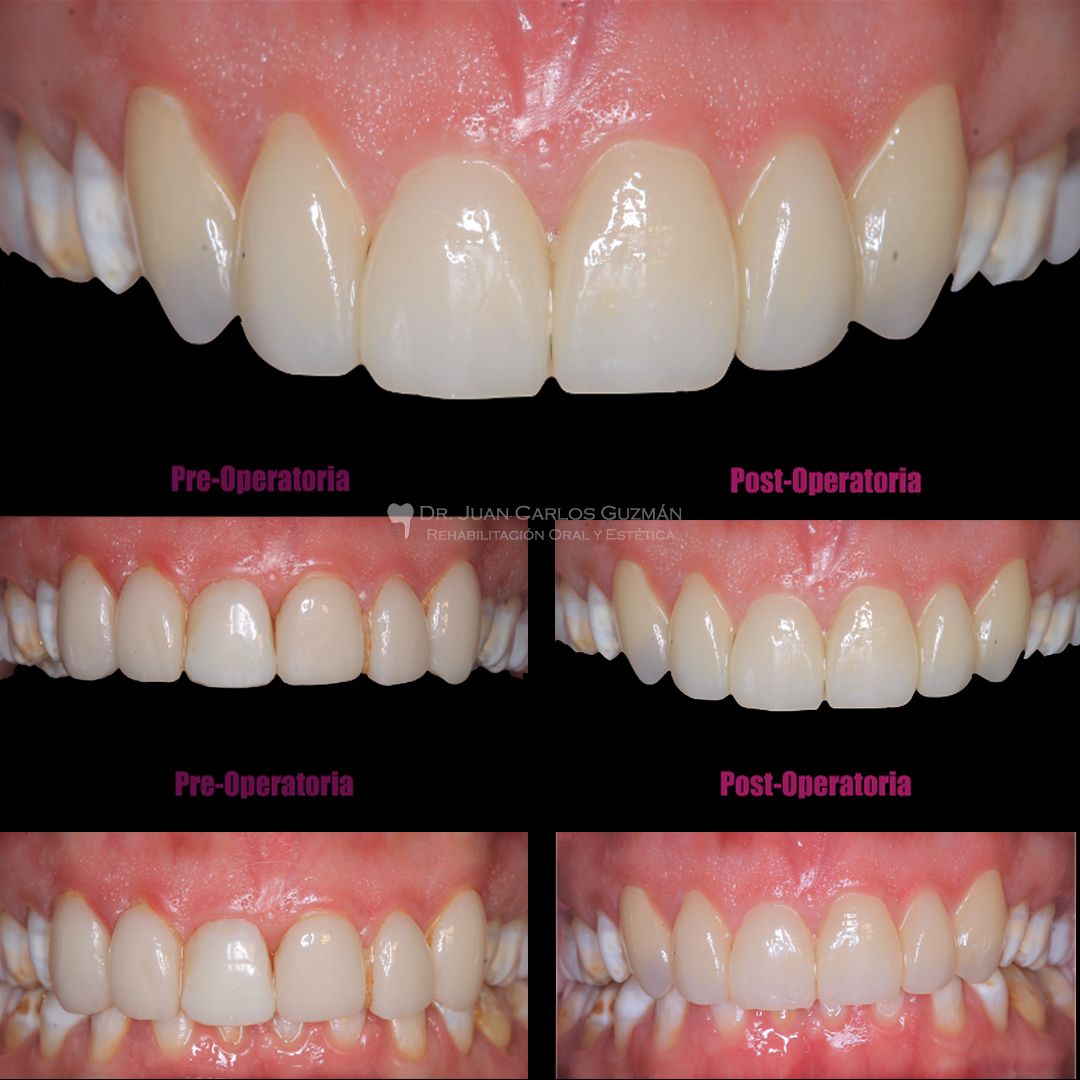 Juan Carlos Guzmán Castañeda-17