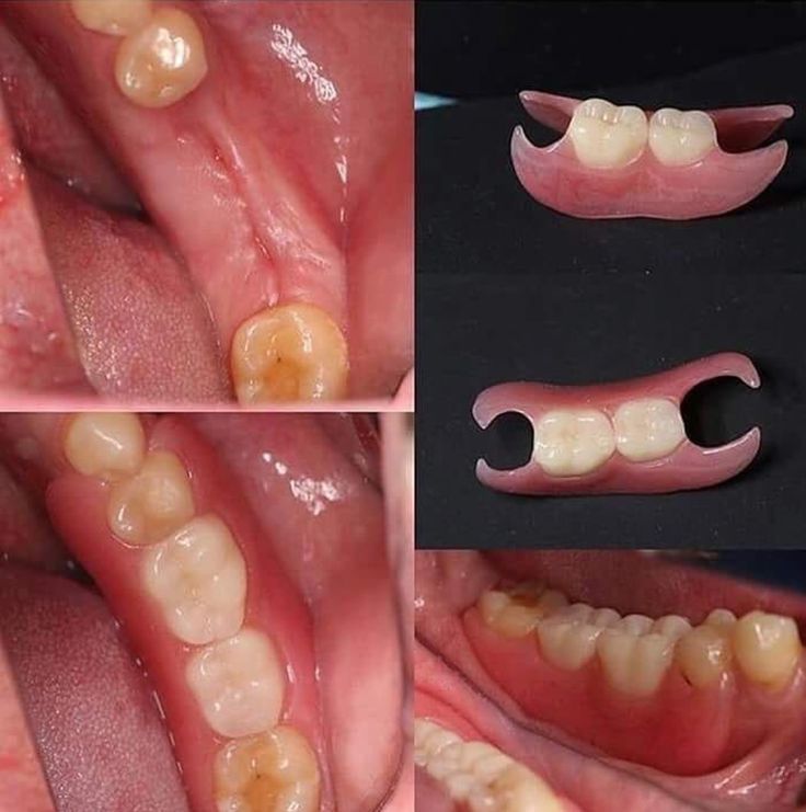 Gloria Haydee Castillo Castellanos-13