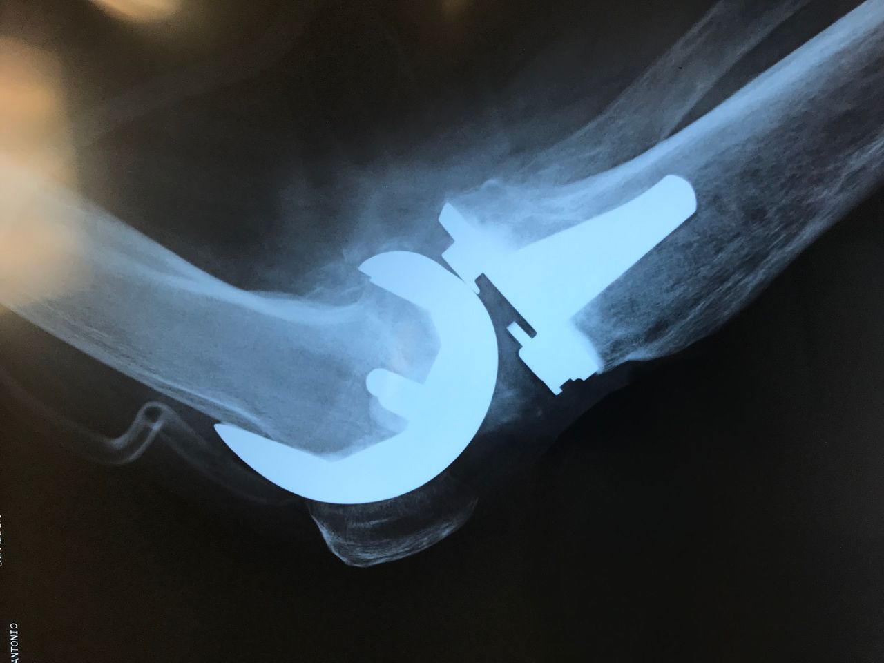 Carlos Alberto Romero Sosa-9