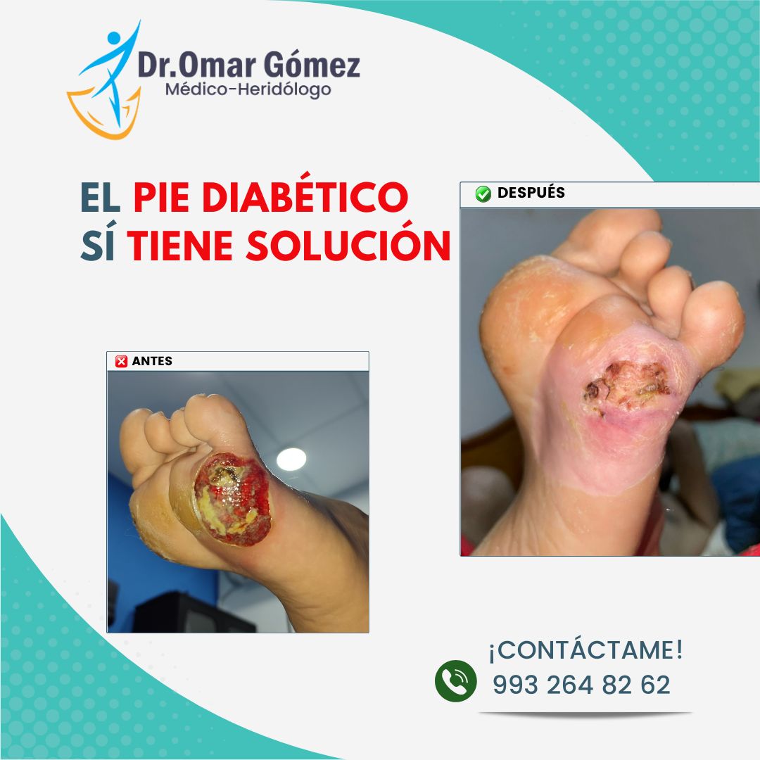 Omar Gómez López-6