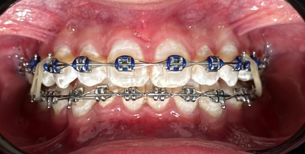 Vicente Emmanuel Silva Rangel-2