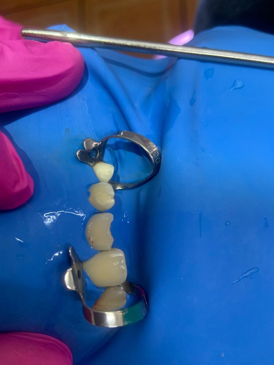 Yutsil Zintzun Corona-2