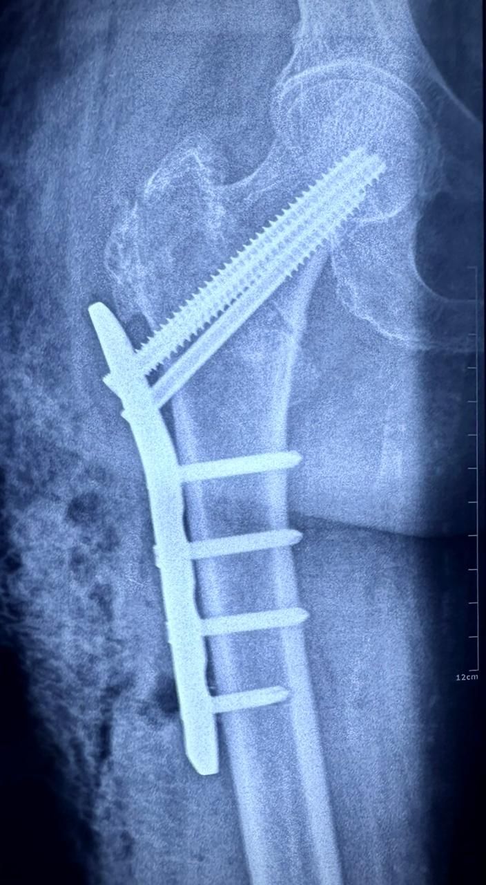 Cristian Ernesto Murillo Medina-5