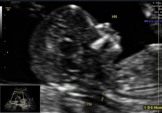 Graciela Elizabeth De La Torre Alvarez-11