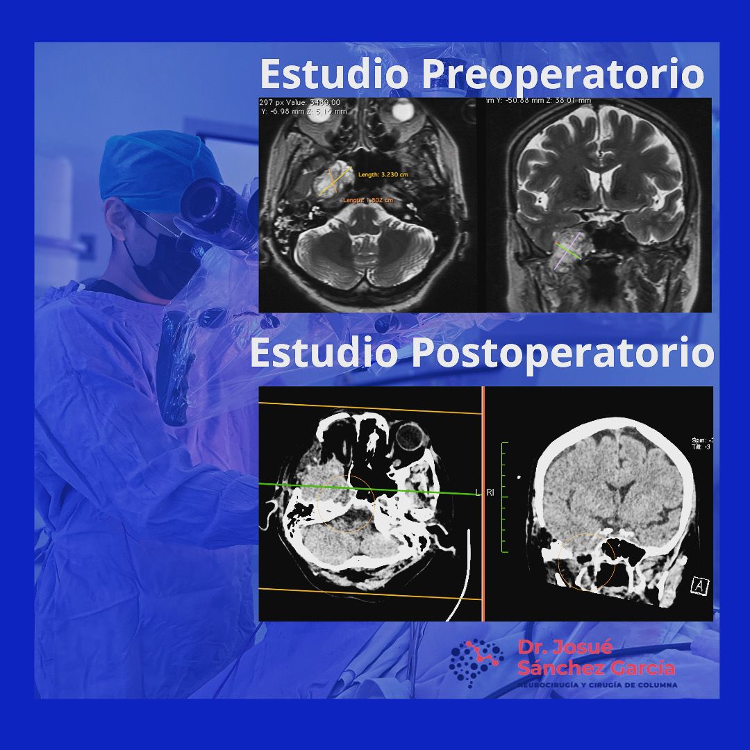 Josué Sánchez García-3