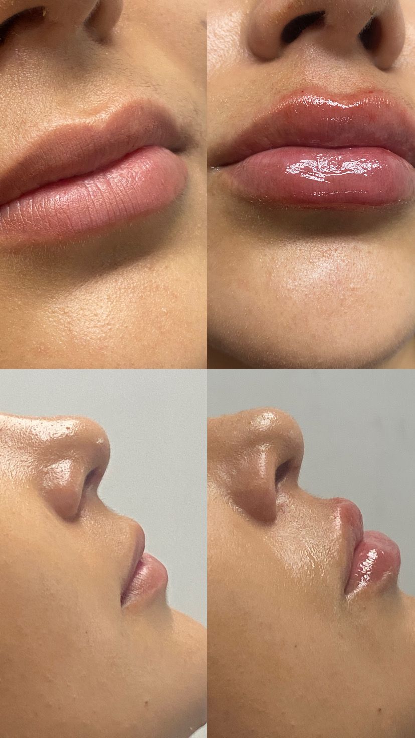 Itzel A Lomelí Gonzalez-2