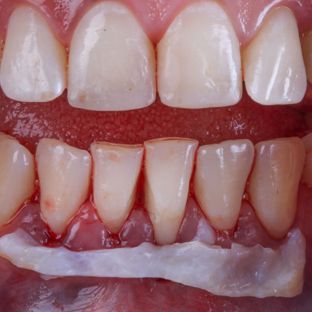 Hugo Enrique Aguilar Lamas-39