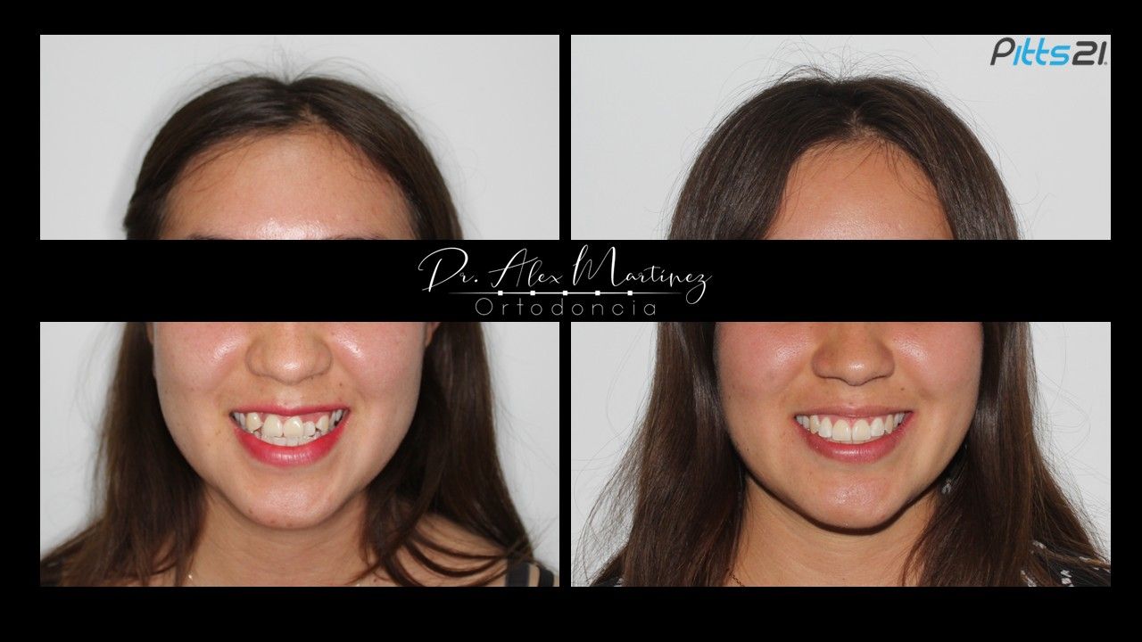 Alejandro Martínez Hernández-22