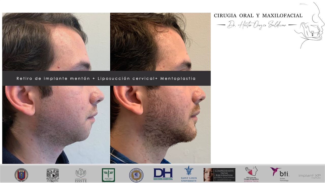 Héctor Adolfo Orozco Saldívar-32